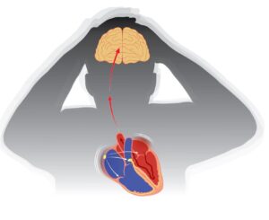 Understanding Atrial Fibrillation: The Dance of the Heart