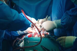 Heart Bypass Surgery: Everything You Need to Know