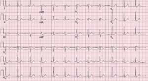 What Is an Echocardiogram? Everything You Need to Know About This Heart Test
